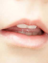 Speech speech Impairment articulation